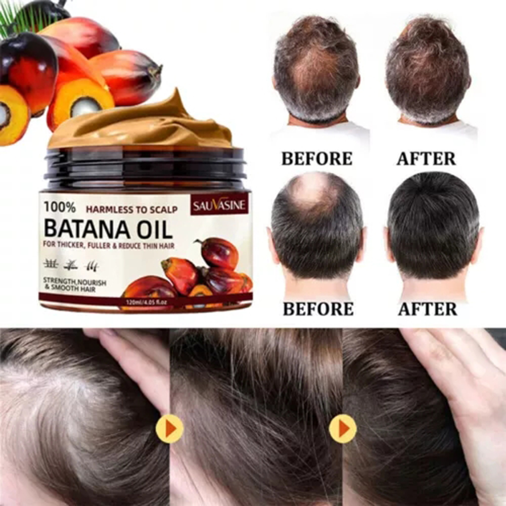 120 ミリリットルバタナ育毛クリーム自然な脱毛治療クリーム - Hair Care Dupes のレビューと価格
