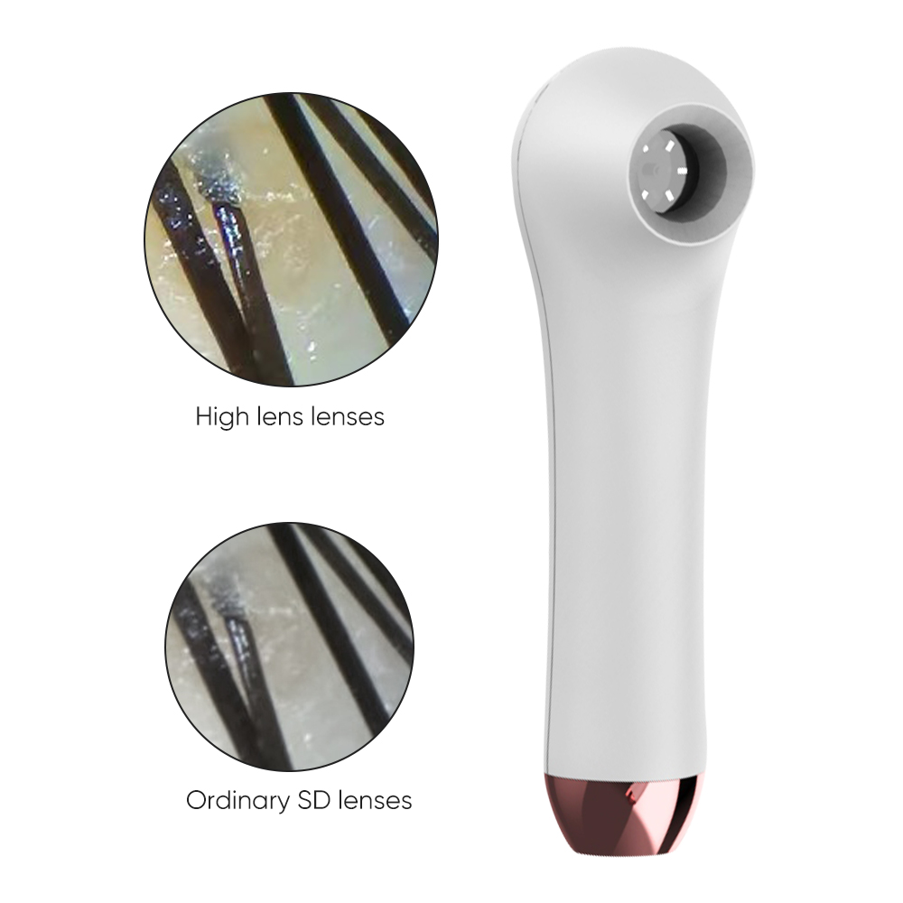 家庭用HD皮膚科フェイススキャナー スマート多機能肌・髪・頭 - Hair Care Homemade のレビューと価格