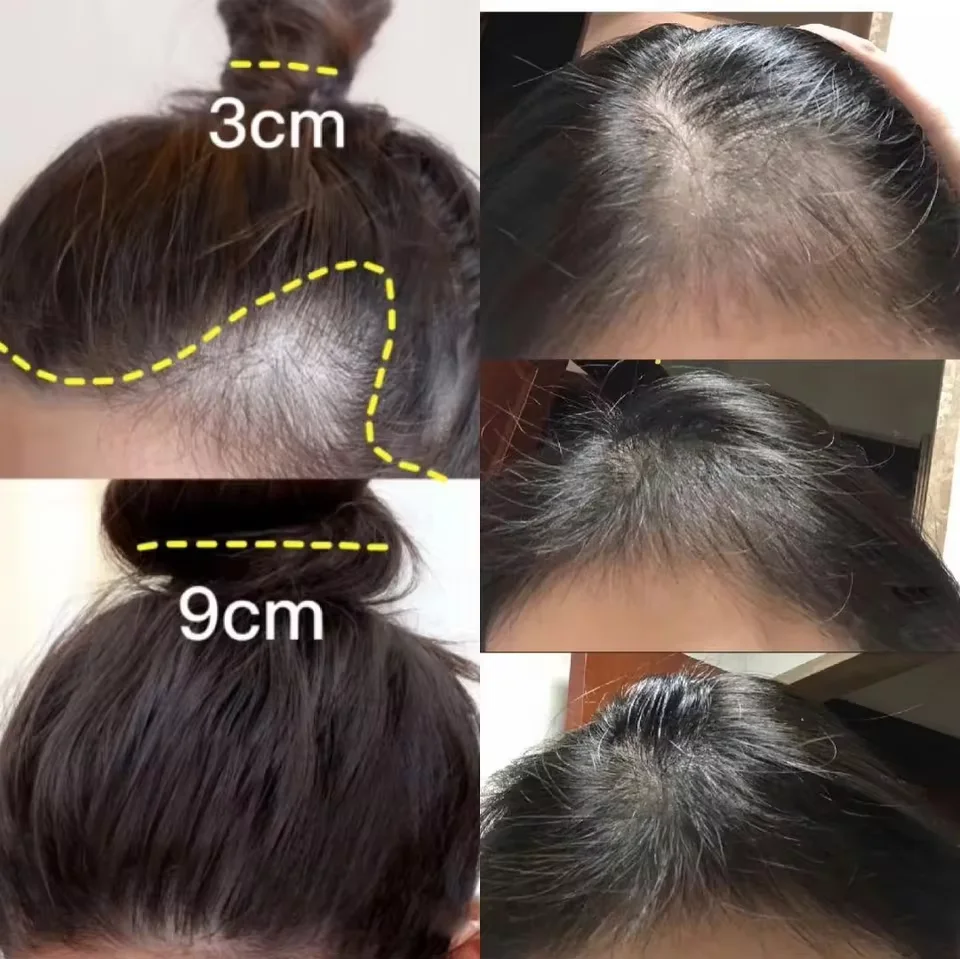 高速生姜育毛クリーム抗脱毛ハゲ修復ダメージ頭皮治療栄養毛根ケ - Hair Care Dupes のレビューと価格