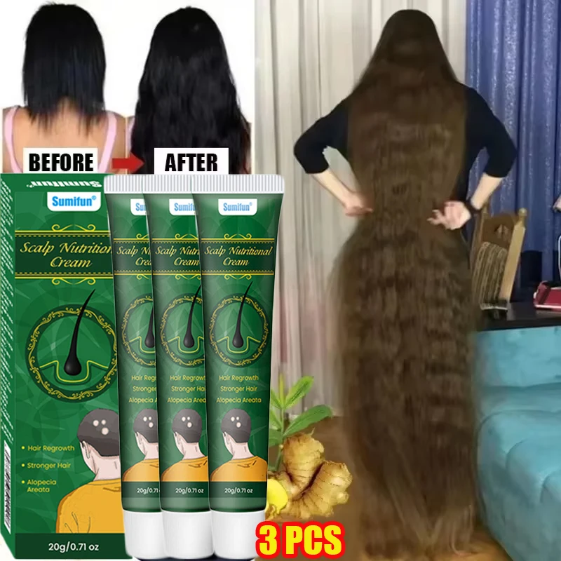 高速生姜育毛クリーム抗脱毛ハゲ修復ダメージ頭皮治療栄養毛根ケ - Hair Care Dupes のレビューと価格